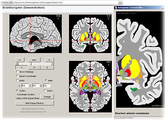 Navigator applet (normal view)