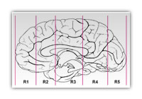 Lines indicate where the hemisphere was cut into 5 blocks (R1 - R5) before embedding.